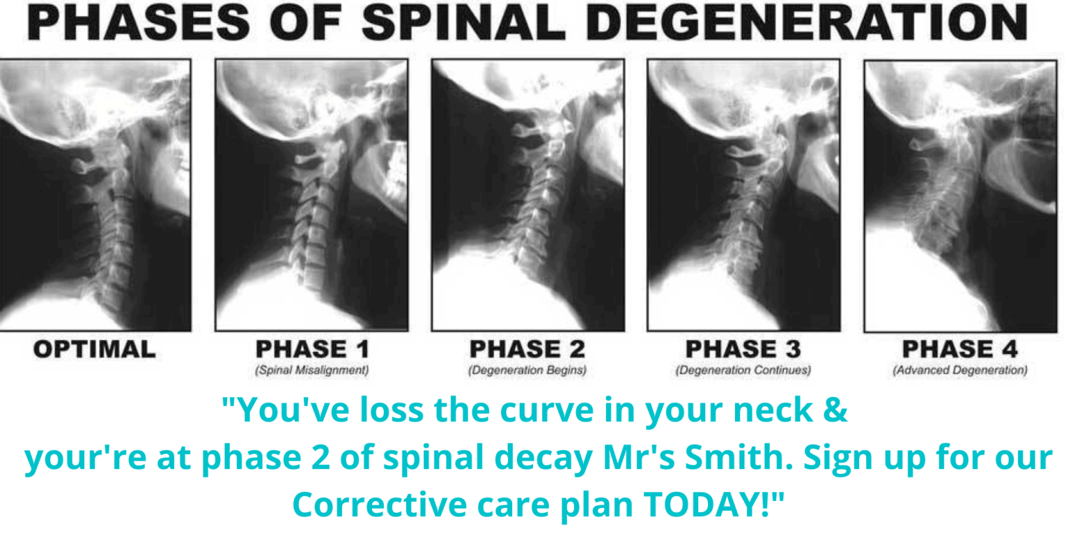 Why X-rays Are So Damaging.